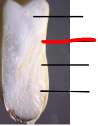 <p>*What is depicted in this longitudinal section made through the middle of the corn kernel?</p>