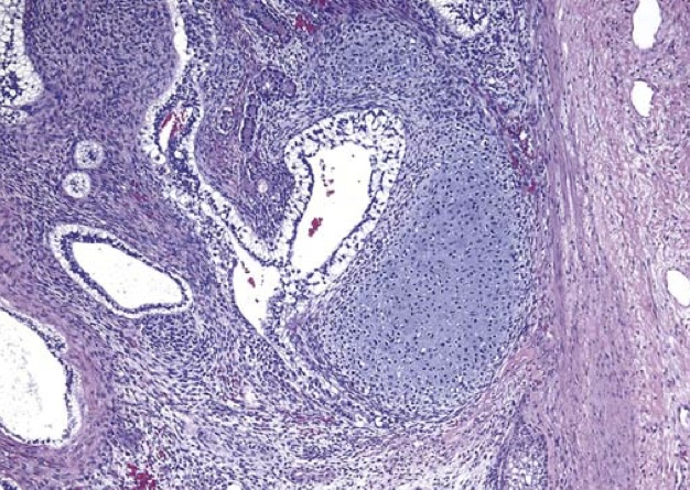 term image