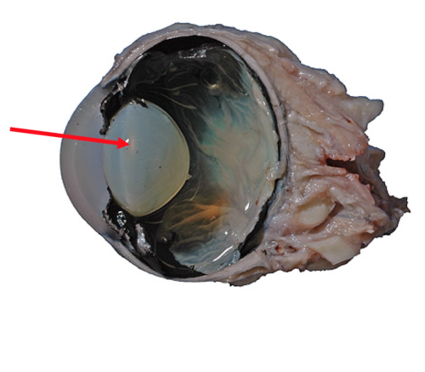 <p>-A clear, flexible structure that makes an image on the eye's retina.<br>-The lens is flexible so it can change shape, focusing on objects that are close up and objects that are far away.</p>