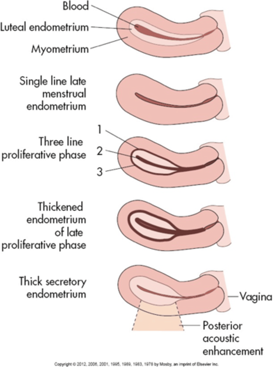 <p>thick; echogenic; 7-14 mm</p>