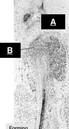 <p>what is B </p>