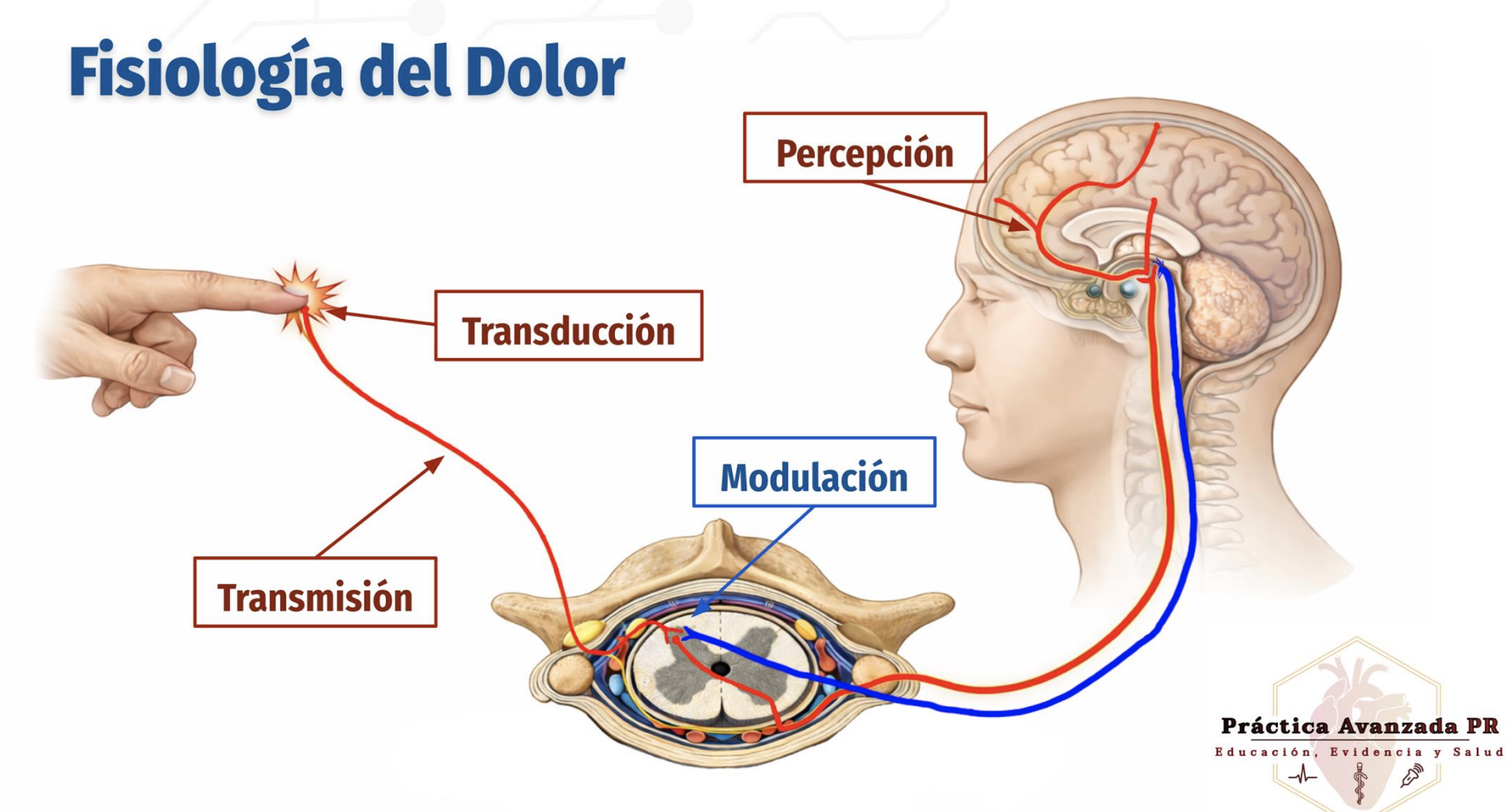 <p>Physiology of Pain</p><ul><li><p>4 stages of pain </p></li></ul><p></p>
