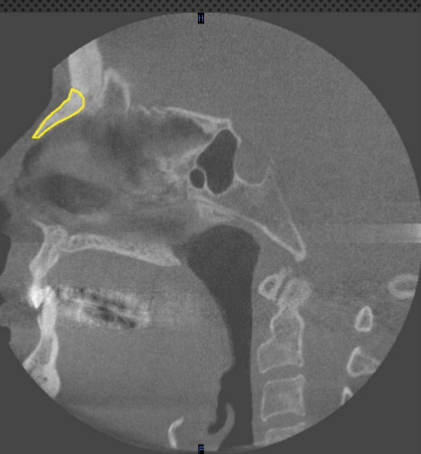 <p>identify the structure </p>