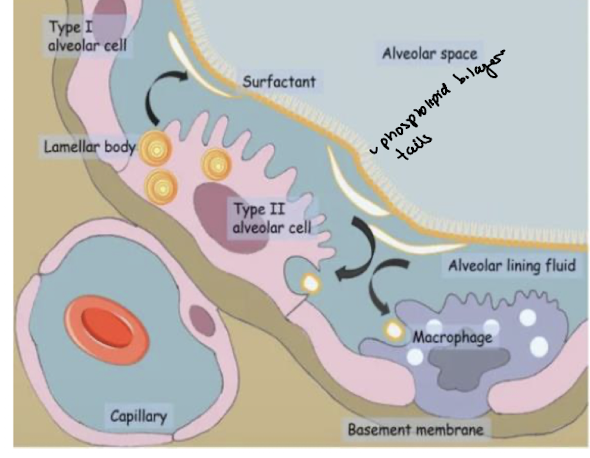 <ul><li><p>SO MANY (90%) of these rounded cells that onyl take up 5% of alveolar SA </p></li><li><p>secrete fluid to keep inner surface moist - gasse sdissolve </p></li><li><p>thicker than AT1 - 10um diameter - dense cytoplasm, more mitochondira, rER/RER and lysosomes </p></li><li><p>many phospholipids synthsized in cytoplasm and stored in <strong>lamellar bodies} -</strong> secreted by exocytosis </p><ul><li><p>they form a single layer on outer surface of film mositure - hydrophilic haeds facing water and tails air of alveolus </p></li></ul></li><li><p>proteins secreted by lamellar bodies are dispered between phospholipid molecules </p></li><li><p>layer acts as a surfactant to reduce surfance tnesions and prevents sides of alveoli from sticking together when air exhaled </p></li></ul><p></p>