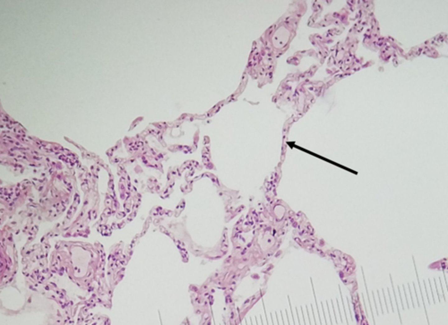 <p>(Single Layer) Function: Allows passage of materials by diffusion and filtration, osmosis</p><p>Location:lungs, walls of capillaries, blood and lymph vessels</p>