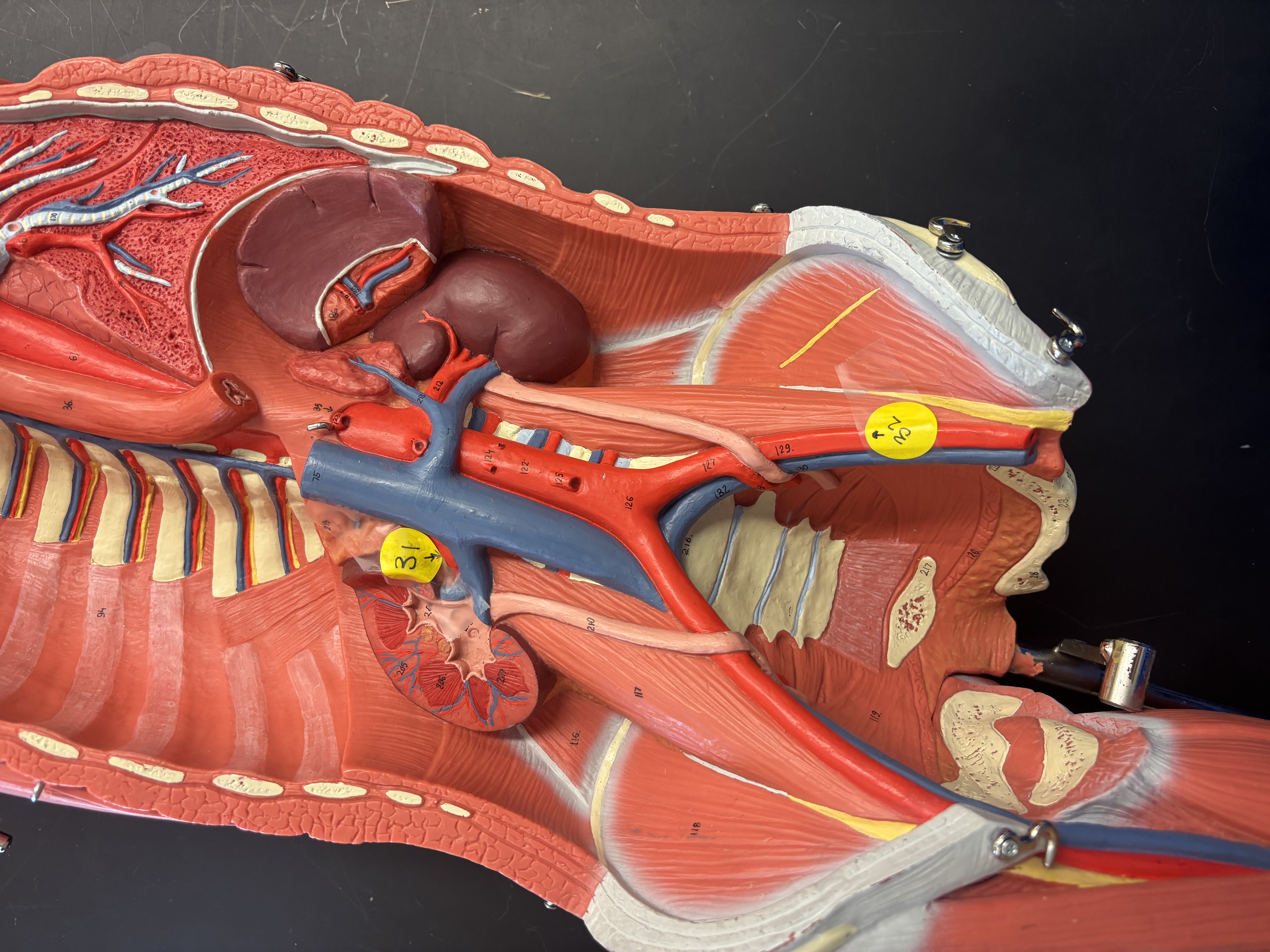 <p>31- right renal artery</p><p>32- left external iliac artery</p><p>38- right renal vein</p>