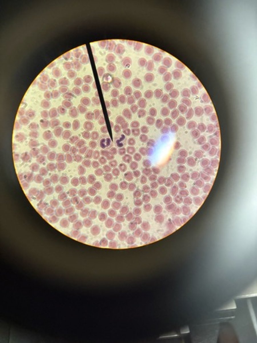 <p>Identify</p>