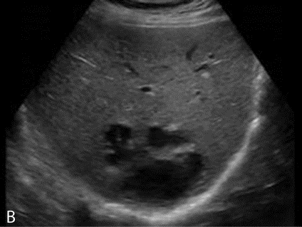 <p>Image 9.48 B</p>