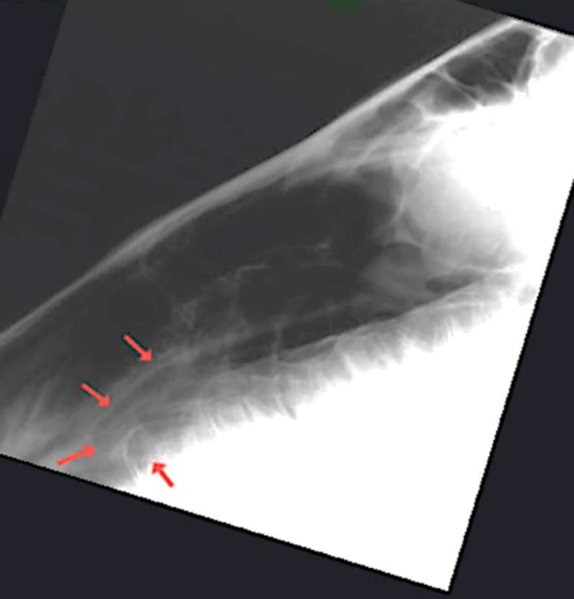 <p>What is the structure shown by the red arrows?</p>