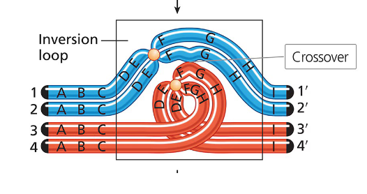 <p>In an inversion heterozygote, the difference in gene order due to the inversion requires a special structural adjustment for proper synaptic alignment during meiosis I. </p><p>This adjustment involves the formation of an <strong>inversion loop</strong>. Chromosomes are flexible enough to form these structures without breakage, allowing homologous regions to pair up.</p><ul><li><p><strong>Example: Allderdice Syndrome:</strong> This syndrome is associated with a pericentric inversion on chromosome 3, identified in Sandy Point, Newfoundland. The discovery was linked to Dr. Penny Allderdice.</p></li></ul><p></p>