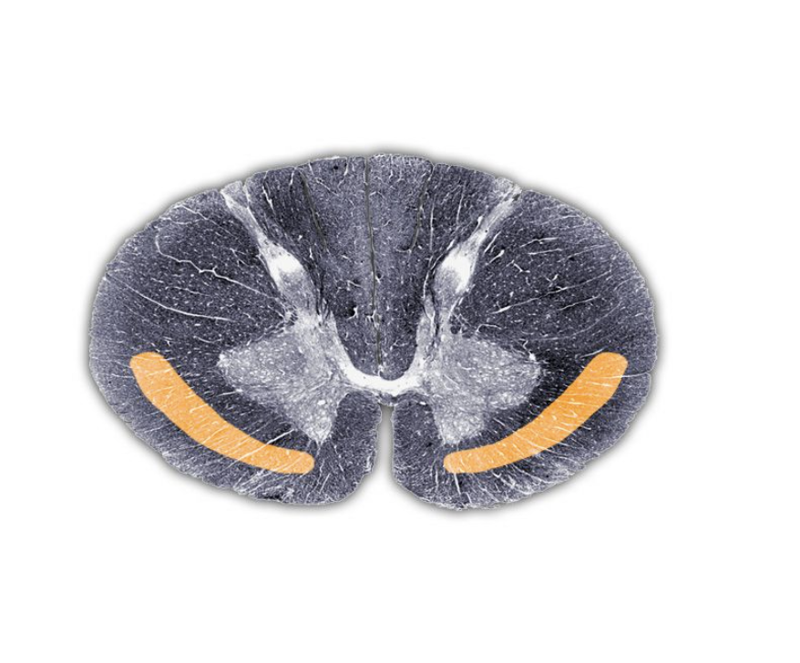 <p>Spinothalamic tract</p>
