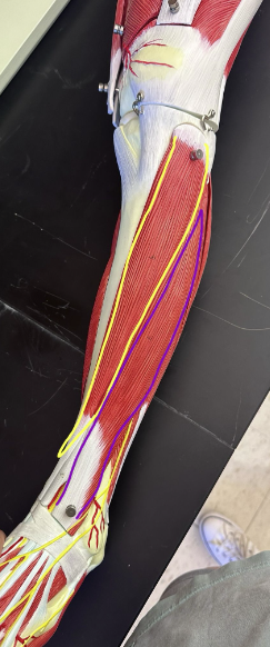 <p>What muscle is the yellow line indicating? What action does this muscle perform?</p>