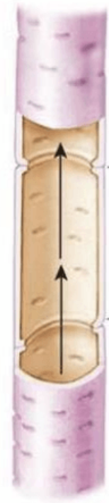 <p>What kind of plant vascular cell is this?</p>