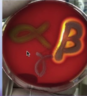 <p>Growth media that cause different organisms to produce different reactions.</p>