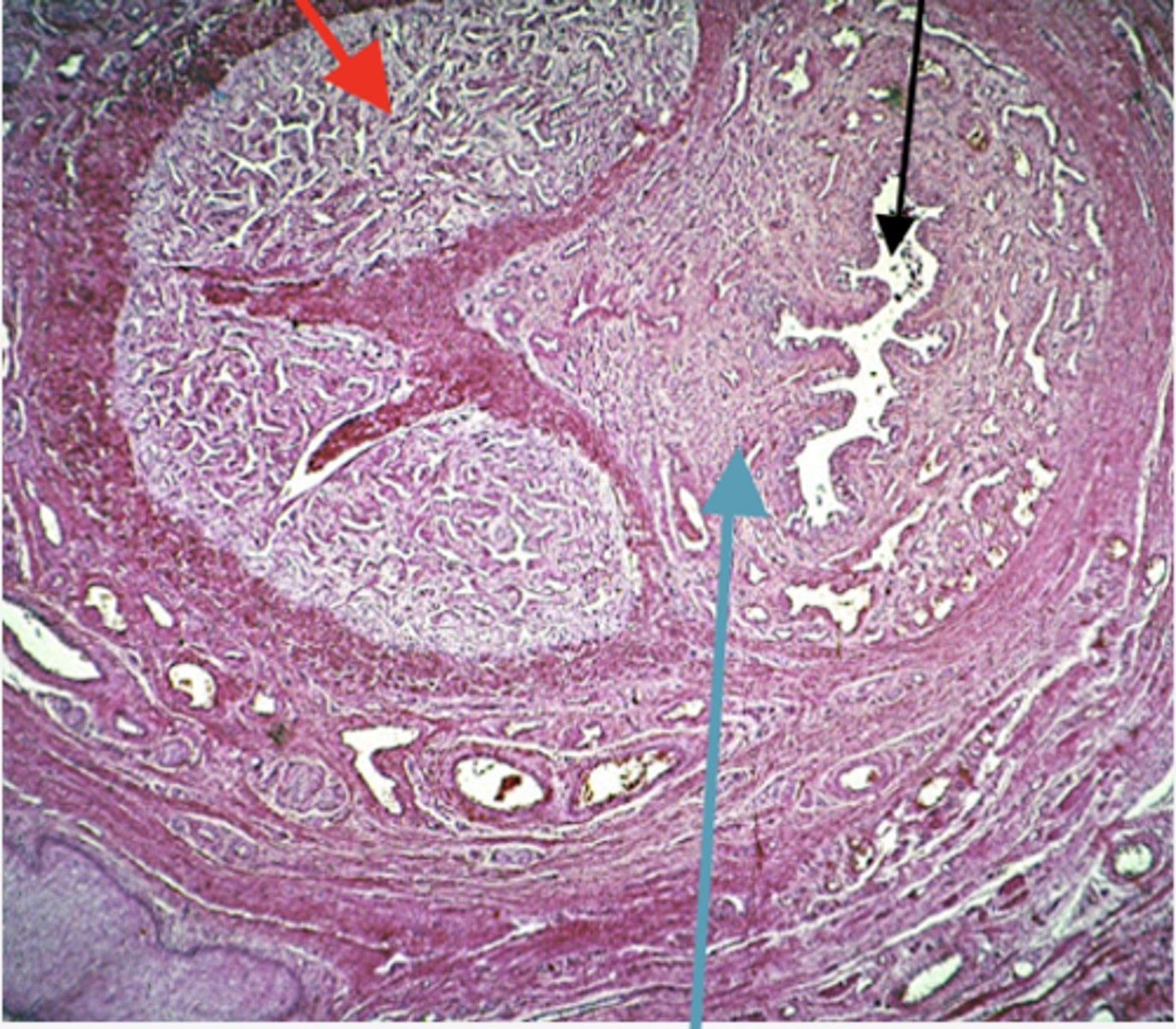 <p>Identify the region (BLACK ARROW)</p>