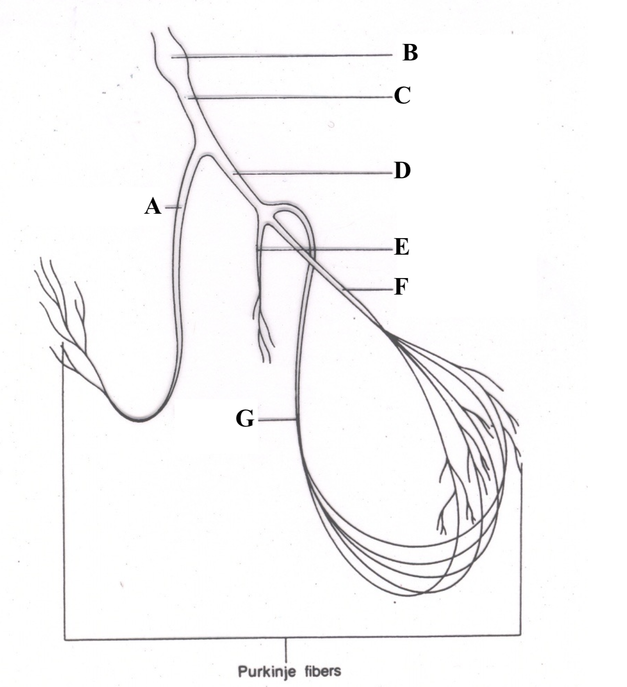 <p>Structure D is the _______ ______ ______.</p>