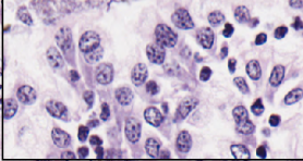 <p>What are these cells from the abomasum of a sheep?</p>