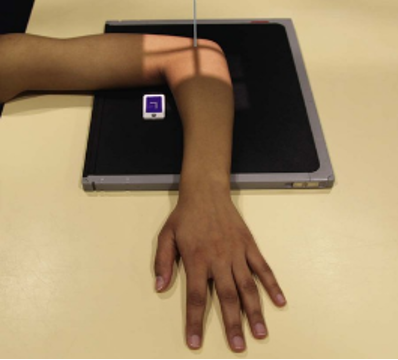 <p>What position would the radial tuberosity face for this position?</p>