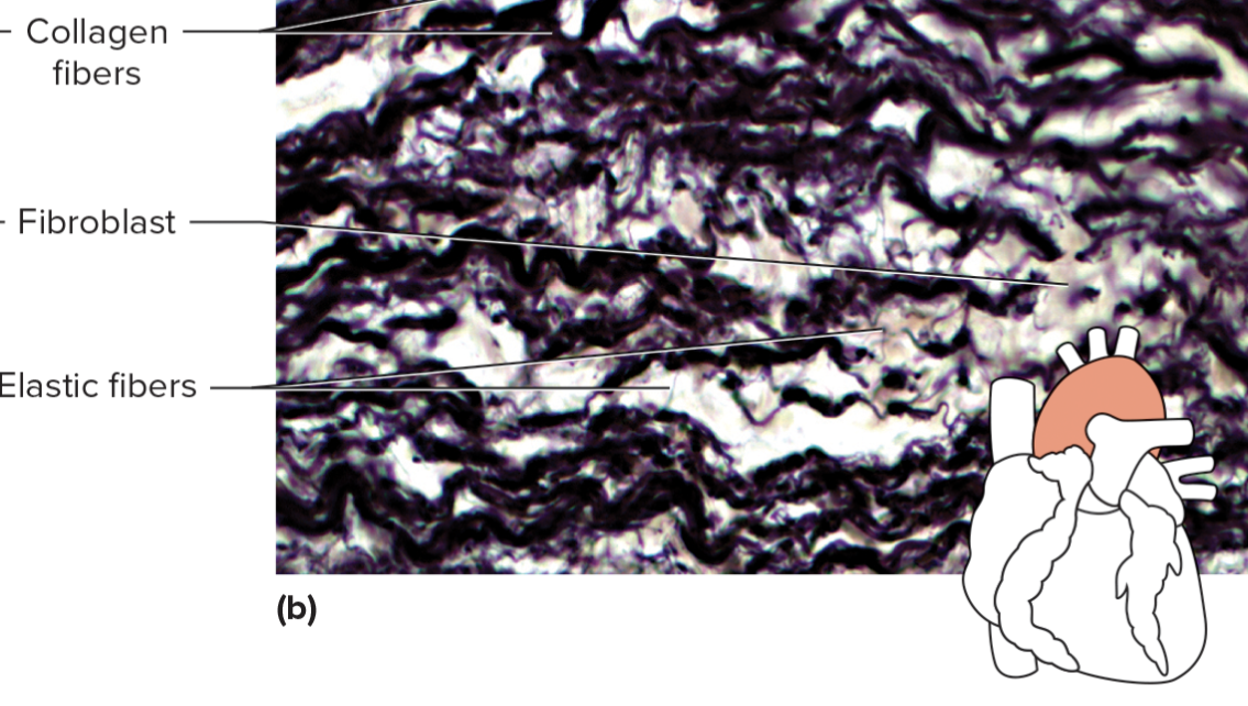 <p>what specific kind of connective tissue is this? </p>