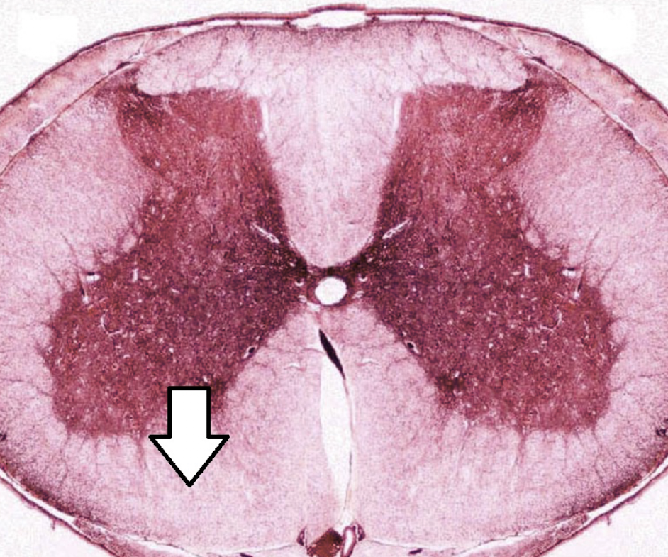 <p>identify the structure (area of white matter)</p>