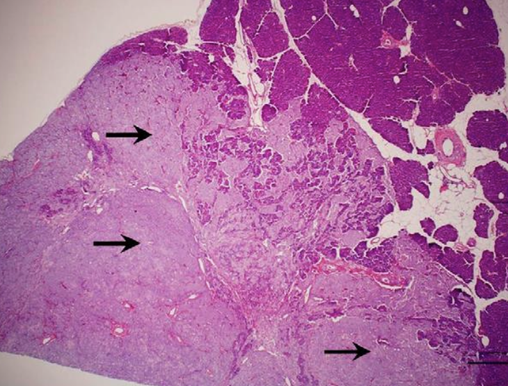 <p>documenting hypoglycemia (BG under 60mg/dL) and concurrent normal or elevated serum insulin concentration</p><p>histopathology</p>