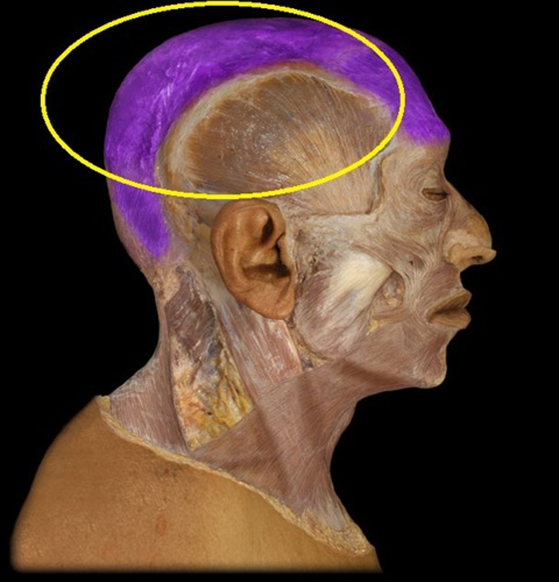 <p>Tendon that connects the occipitalis and frontalis muscles</p>