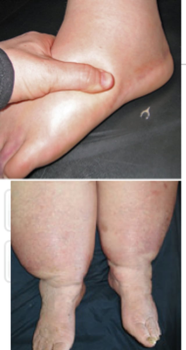 <p>legs and feet</p>