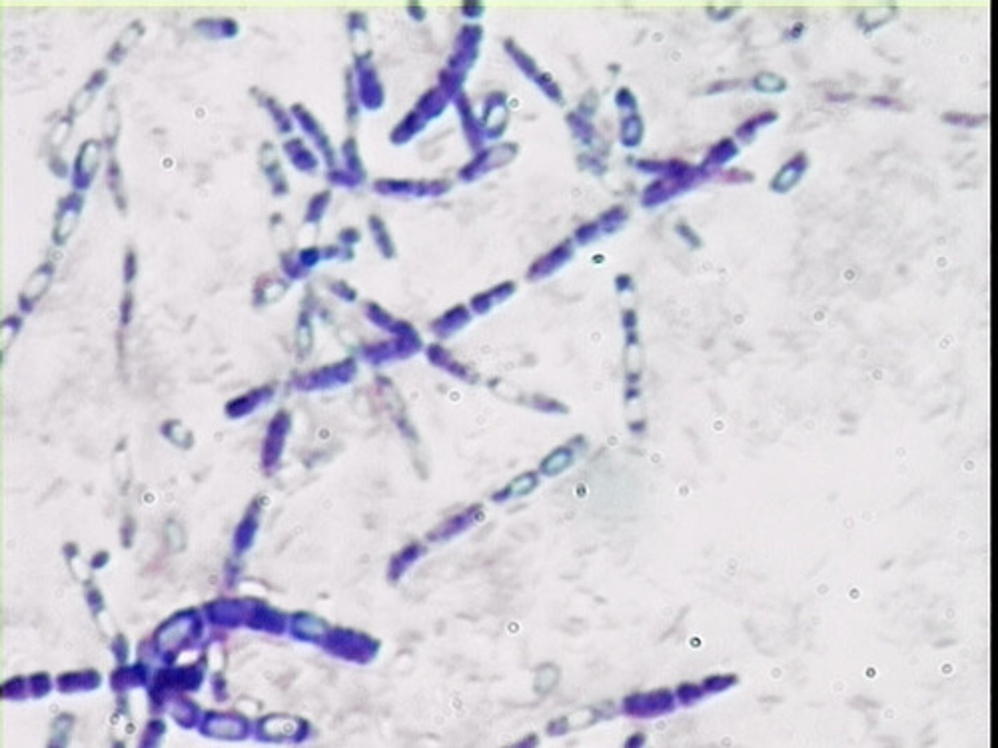 <p>Listeria monocytogenes</p><p>Corynebacterium spp</p>