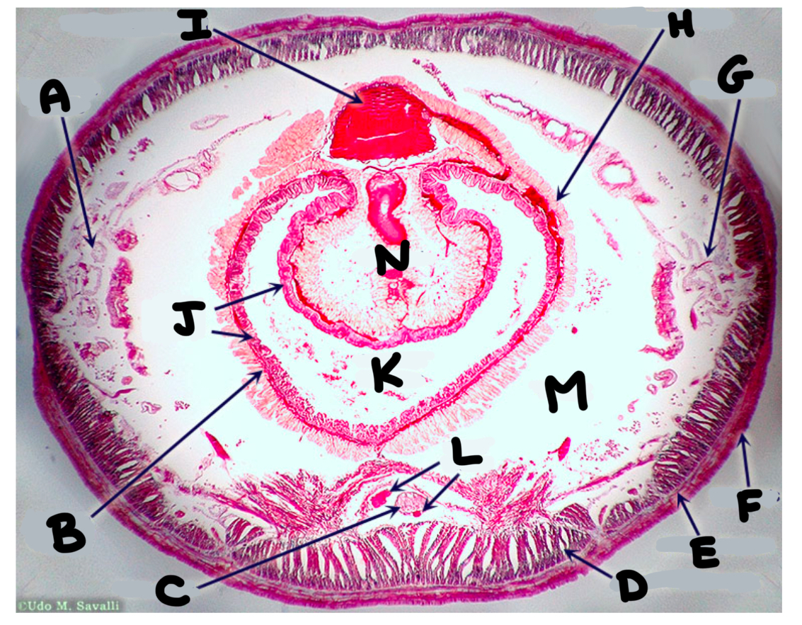 <p>What part of the earthworm is labeled F</p>