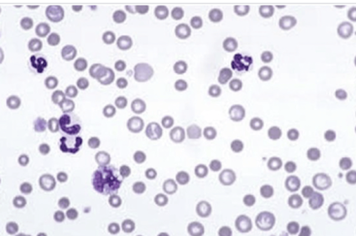 <p>nonregenerative or regenerative? why?</p>