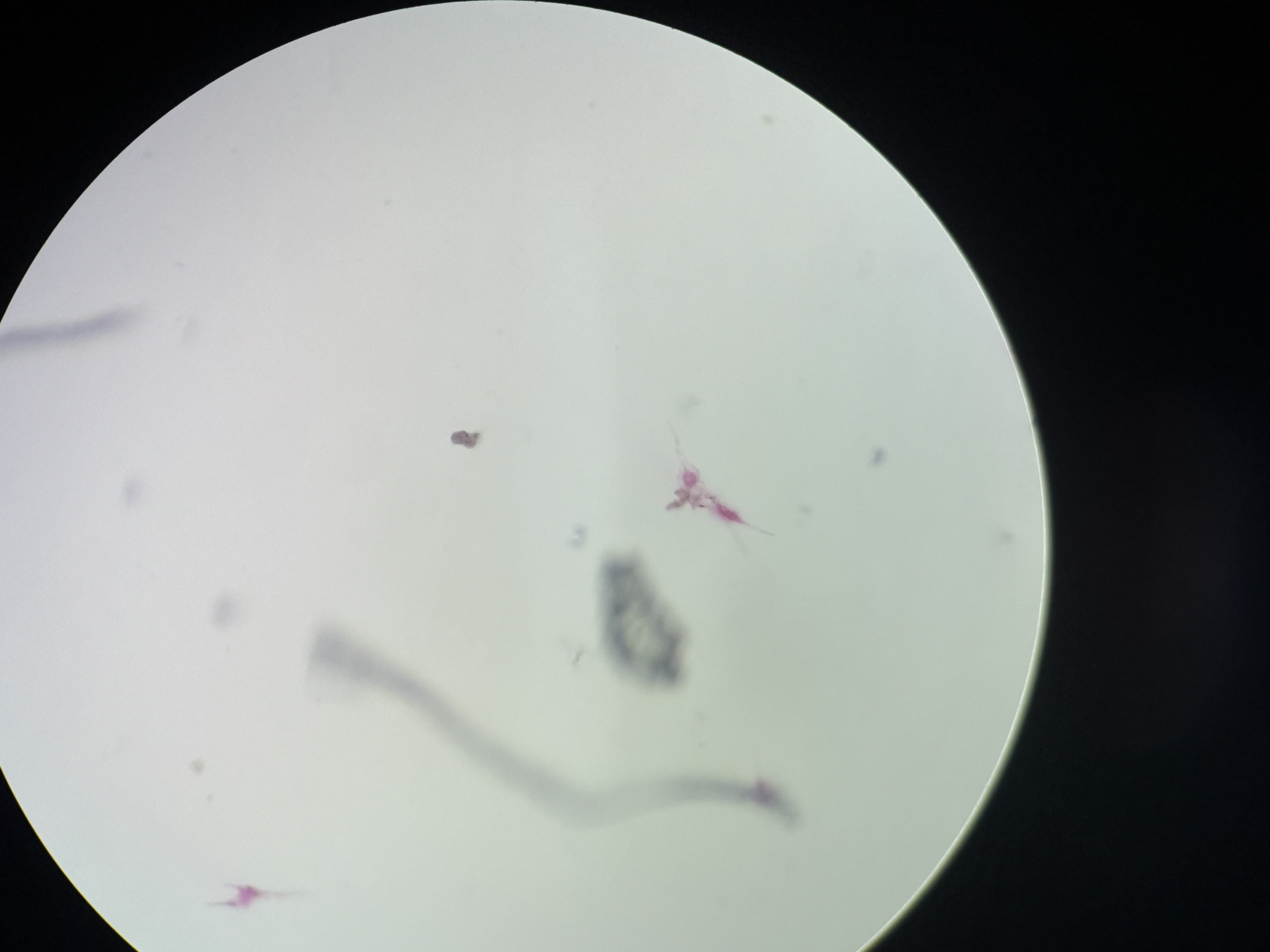 <p>Ceratium</p>