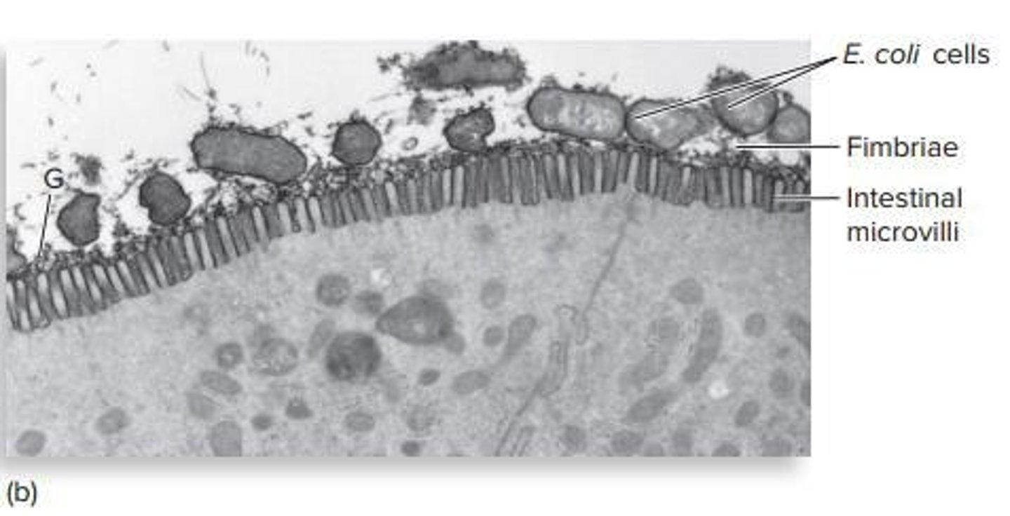 <p>A group of organisms that share high genetic similarity and common characteristics, e.g., Escherichia coli.</p>
