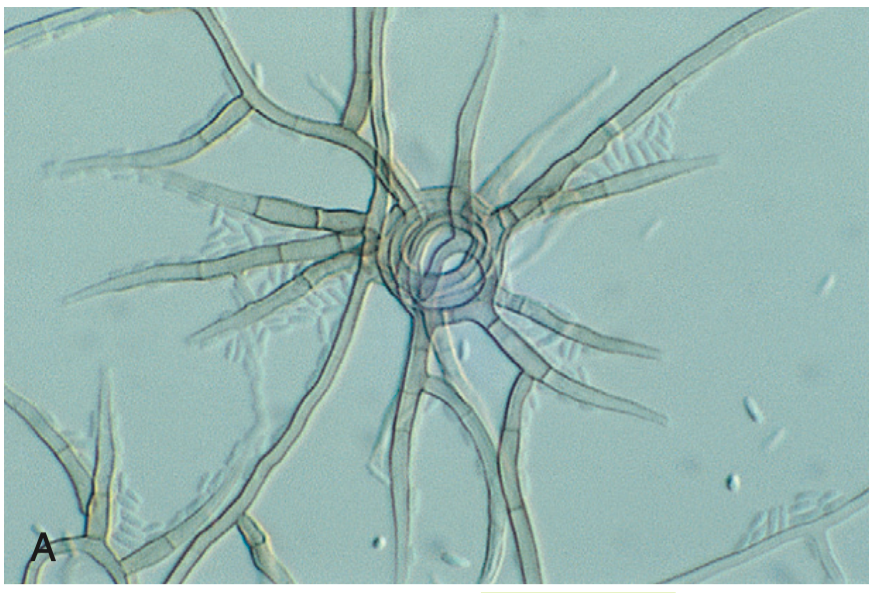 <p>A genus of filamentous fungi commonly found in soil and plants.</p>