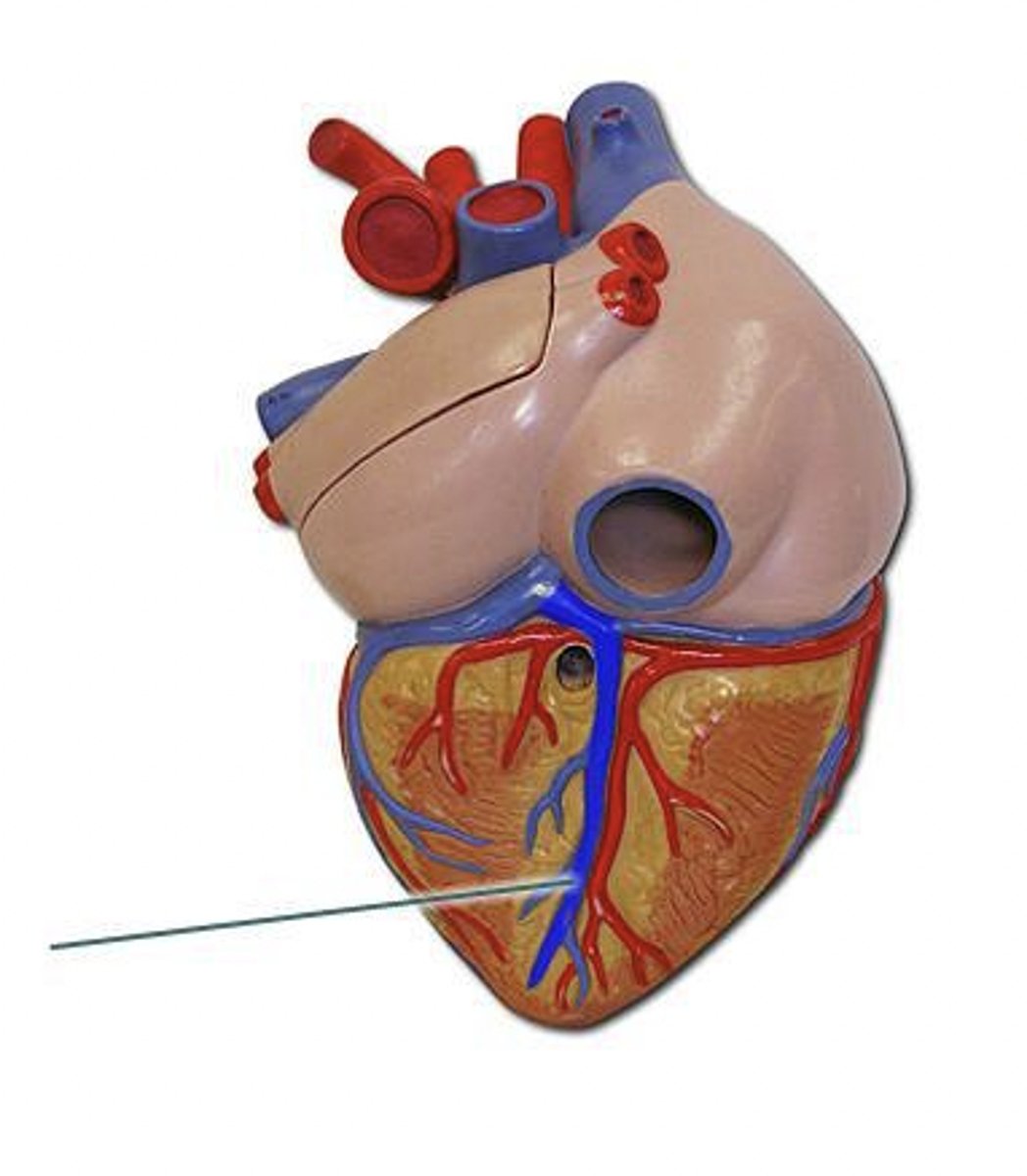 <p>Identify the highlighted vessel.</p>