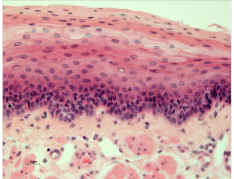 <p>Epithelial</p>