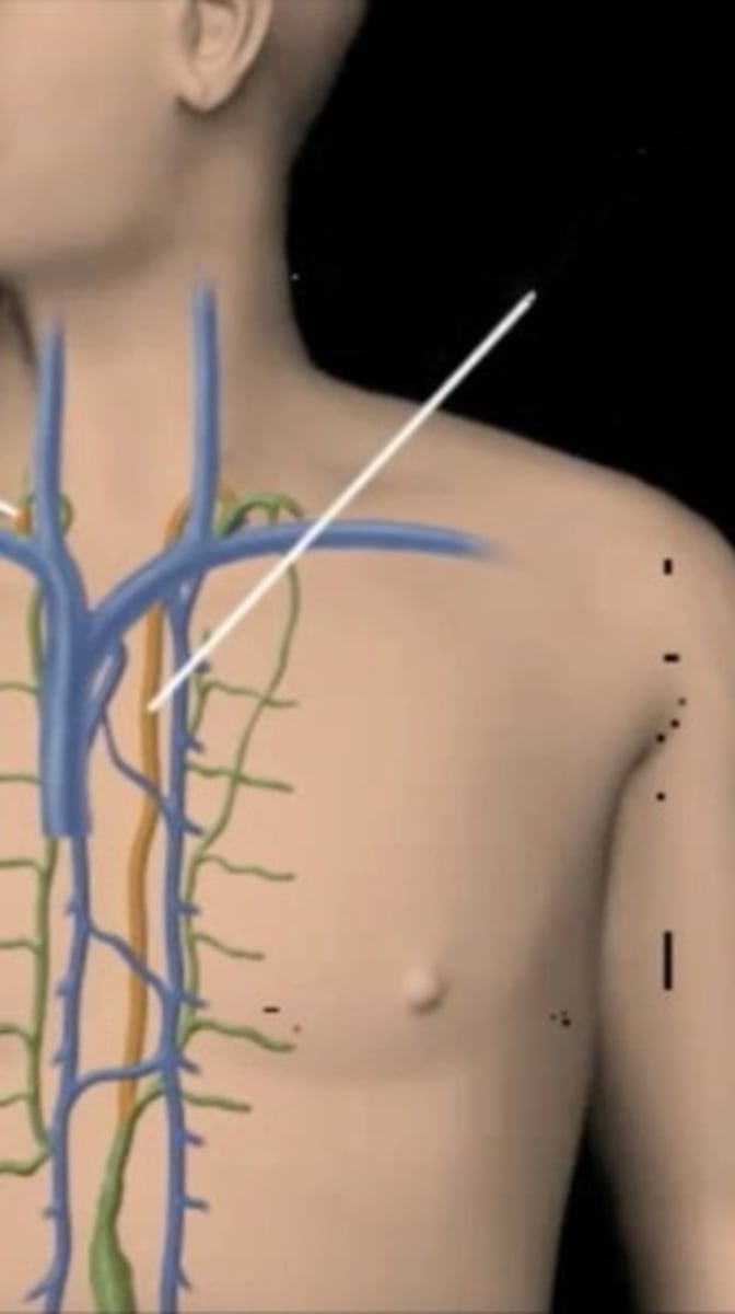 <p>Which lymphatic structure is this white line pointing to?</p>