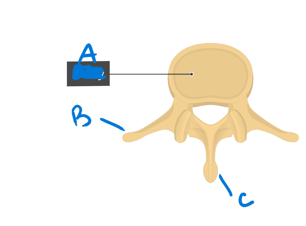 <p>C</p>