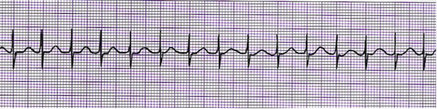 <p>What is this rhythm?</p>