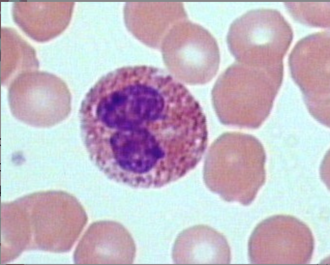 \-2-4% \n -2 lobed (Bilobed) nucleus \n -Allergies & parasitic infection \n -Orange/pink granules
