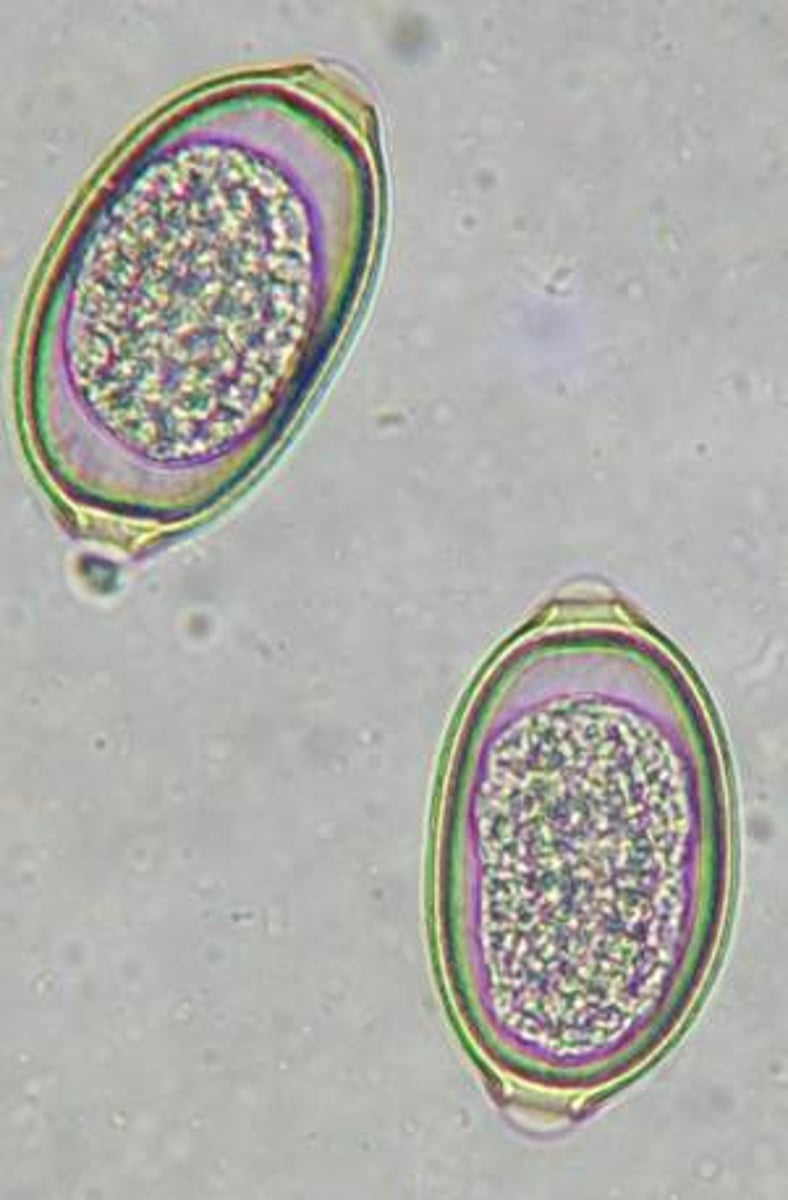 <p>These eggs were found on the fecal flotation of a sneezing dog. What transmission pathway is the most likely way the dog was infected?</p>