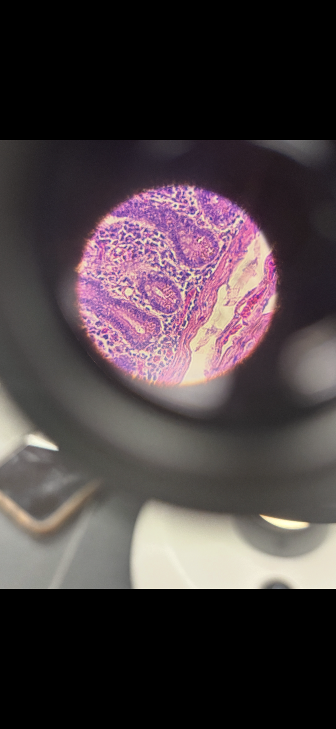 <p>Body location: lining the stomach</p>