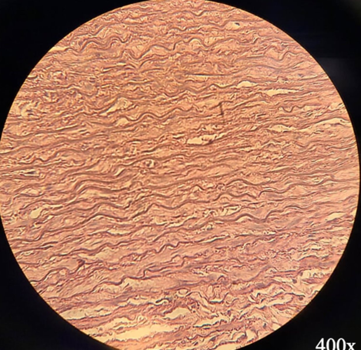 <p>Name the epithelium</p>