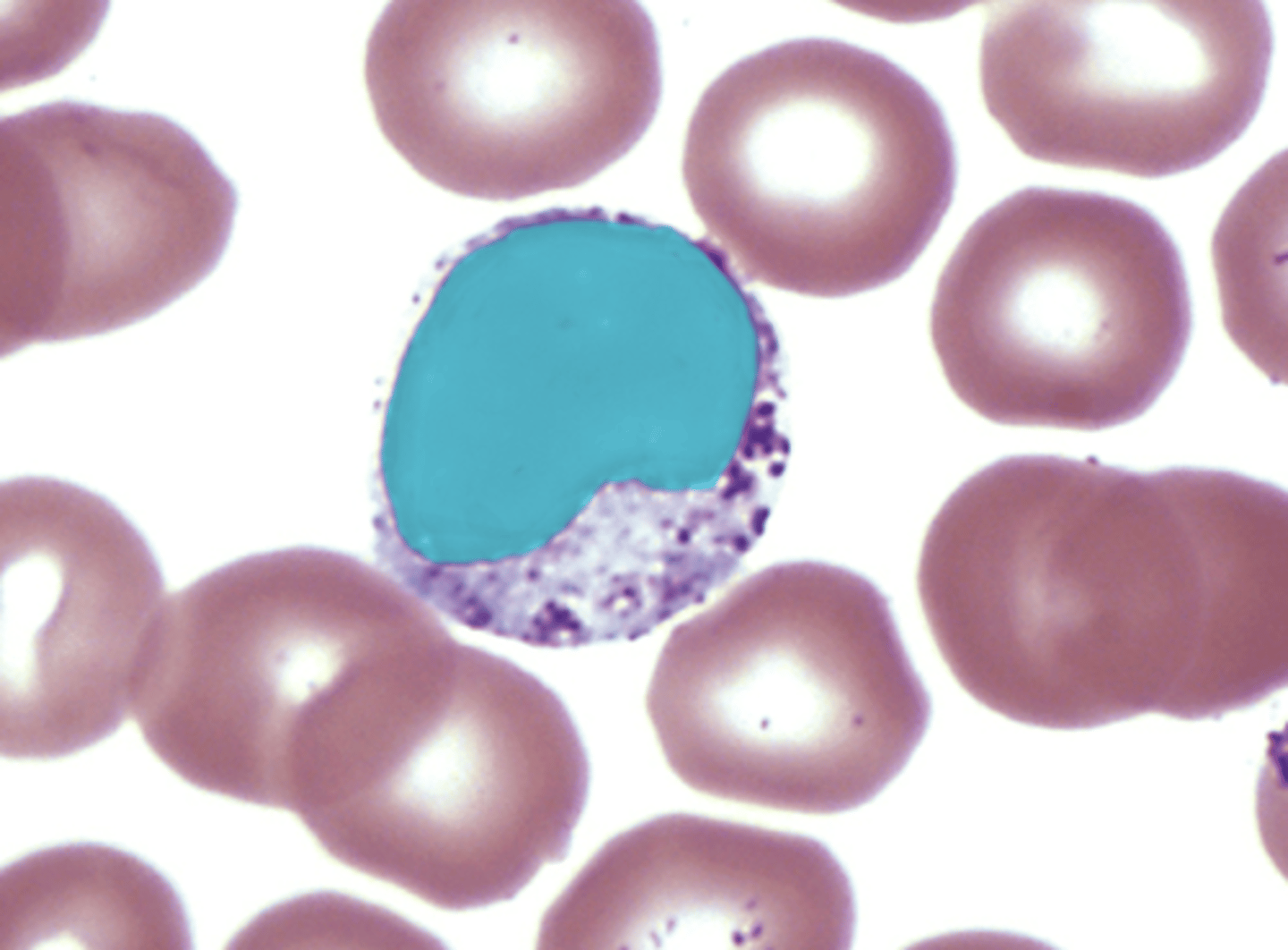 <p>- large, horseshoe nucleus</p>