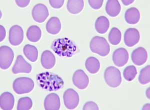 Late schizont plasmodium ovale
