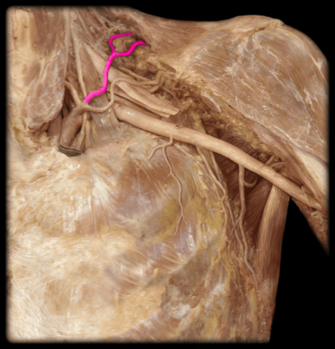 <p>Name the Artery</p>