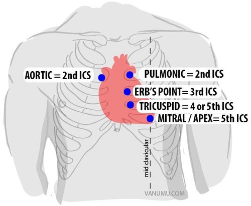 <ul><li><p>AV aortic valve</p><ul><li><p>R 2nd ICS (near sternum)</p></li></ul></li><li><p>PV pulmonary valve</p><ul><li><p>L 2nd ICS (near sternum)</p></li></ul></li><li><p>BV bicuspid valve</p><ul><li><p>L 5th ICS</p></li></ul></li><li><p>TV tricuspid valve</p><ul><li><p>L 5th ICS MCL (midclavicular line)</p></li></ul></li></ul>