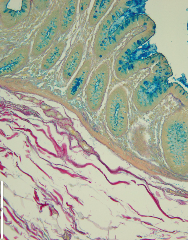 <p>Less specific than AB but more sensitive</p>