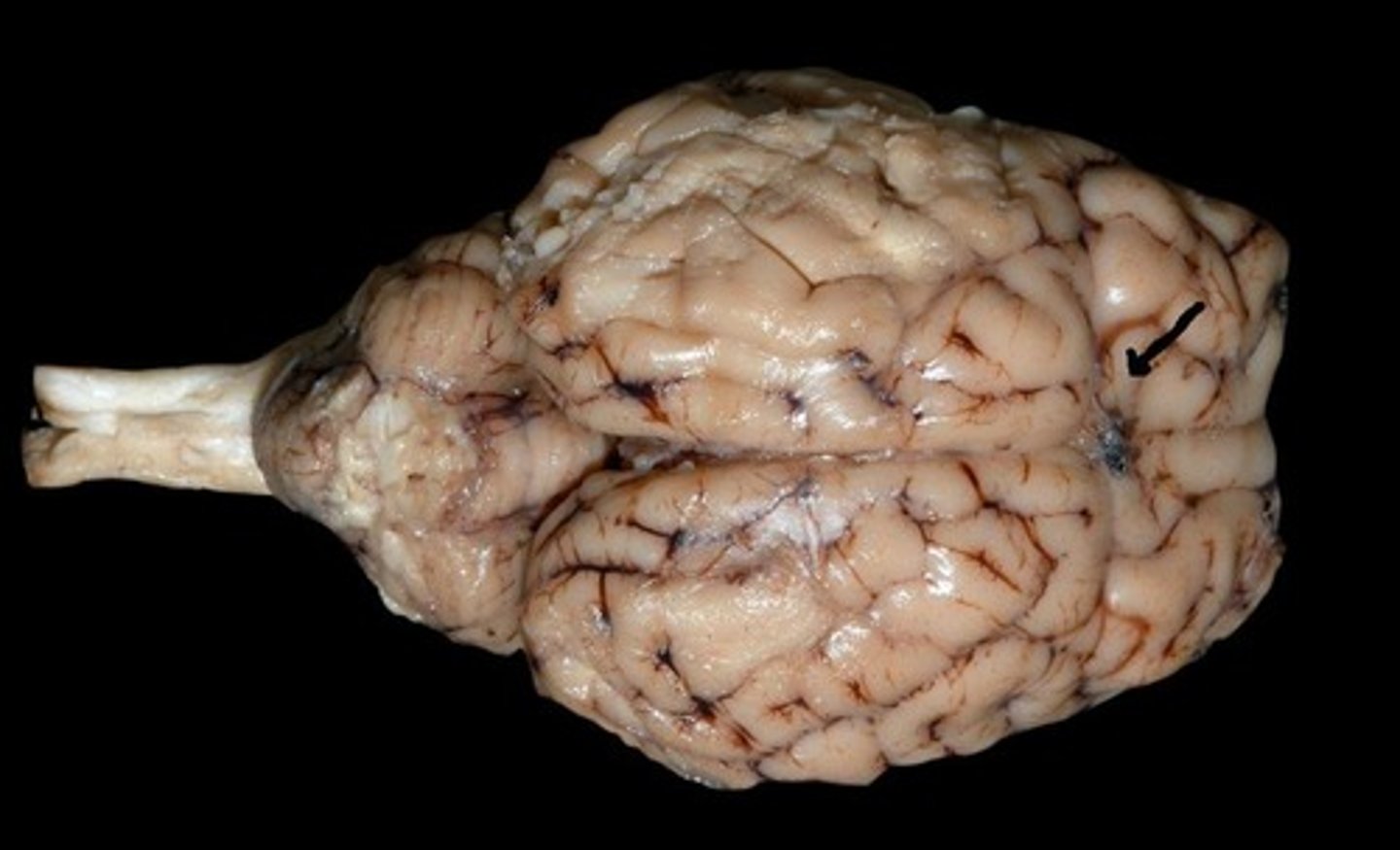 <p>the strip of frontal cortex, just in front of the central sulcus, that is crucial for motor control</p>