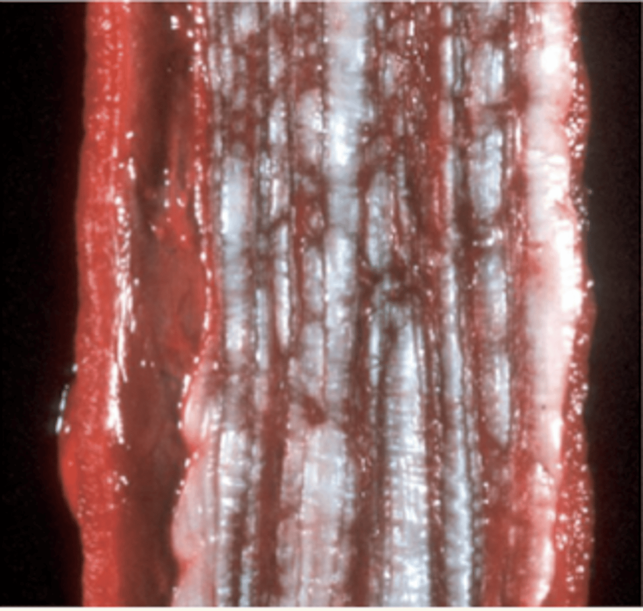 <p>¿diagnóstico morfológico?</p>