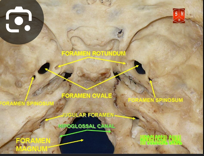 <p>Hypoglossal canal:</p>